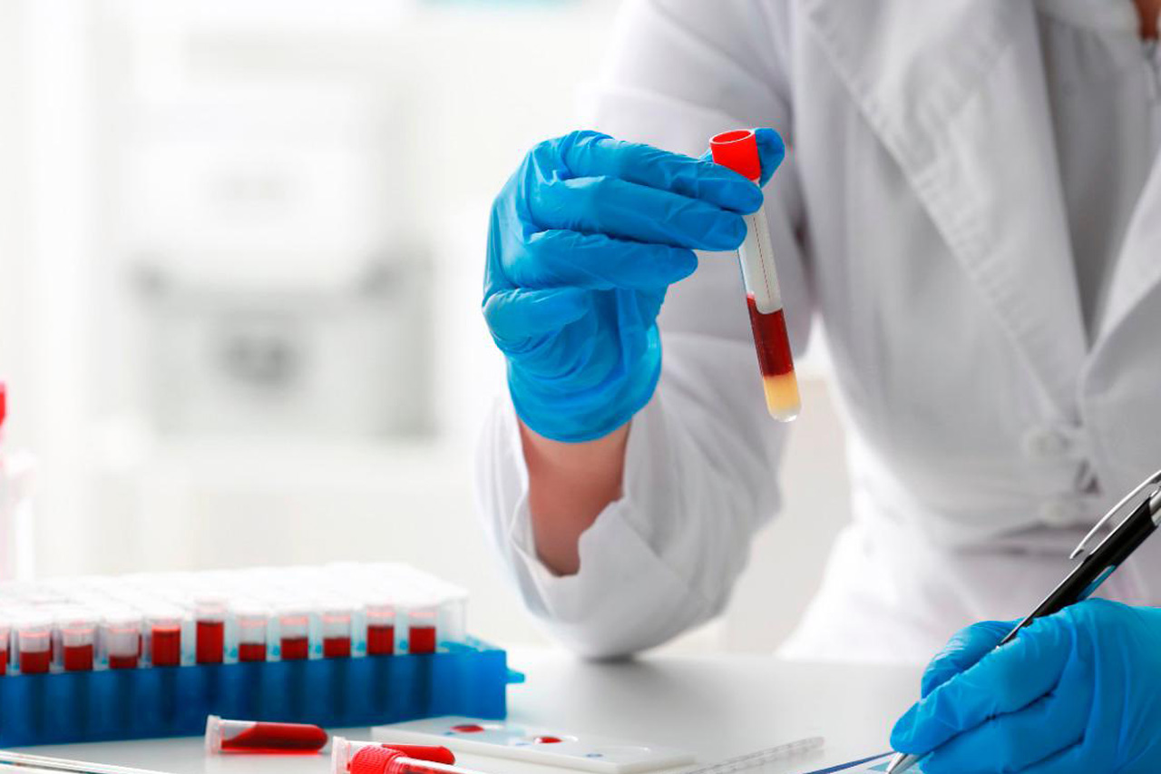 Finito il budget regionale, i cittadini devono pagare le analisi in laboratorio